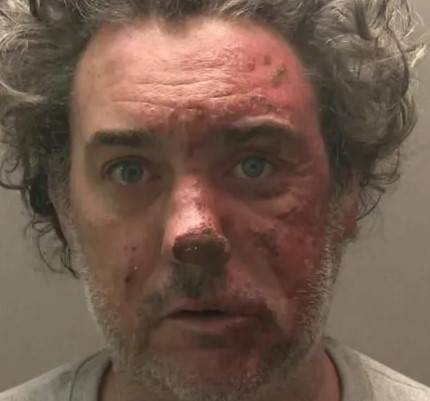 Man Lights Girlfriend on Fire During an Argument – The Case of Ellen Marshall